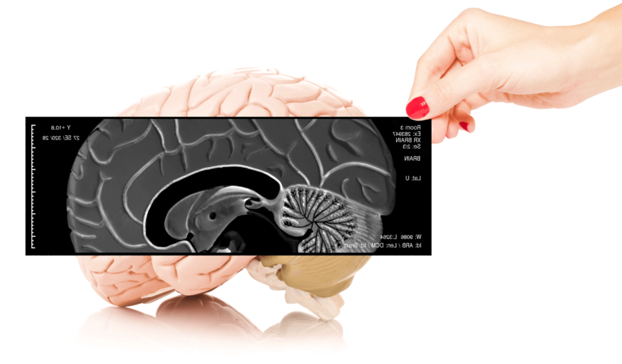 Le cours anatomie physiologie pathologie ASCA discute largement du système nerveux humain et notamment du cerveau